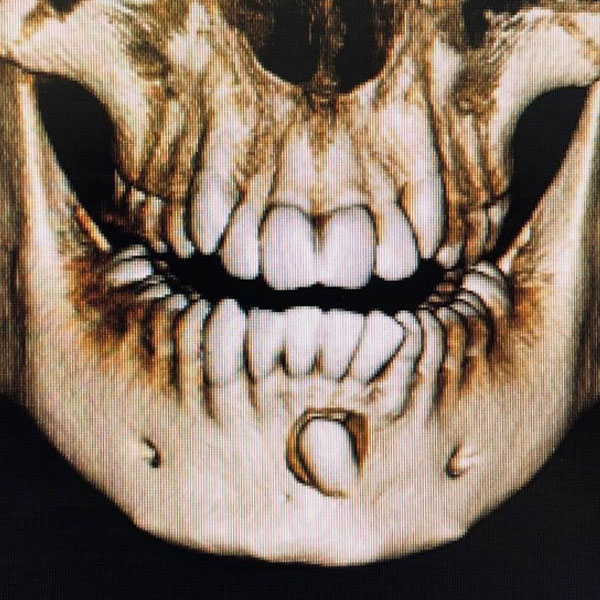 Alberti Ortodonzia radiologia